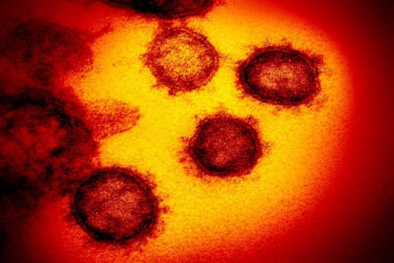 New South Africa coronavirus variant detected in UK that’s ‘highly concerning and more infectious’