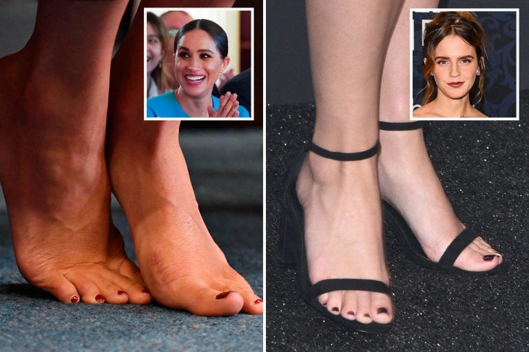 Meghan Markle has the ‘world’s most beautiful feet’ while Emma Watson’s are ‘near perfect’…