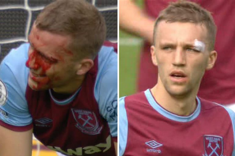 Tomas Soucek covered in blood after gruesome head clash with Sanchez but returns to pitch just seven…