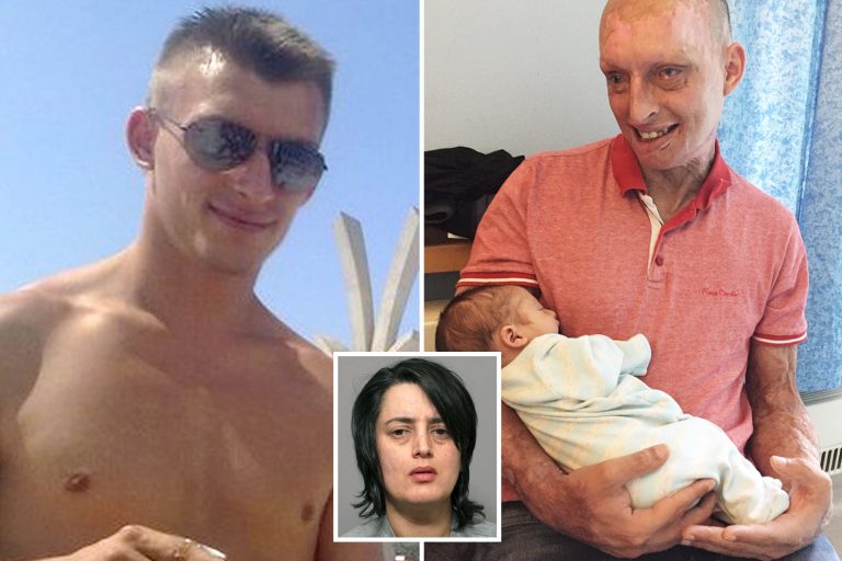 Man, 35, whose ex poured acid over him as he slept reveals he ‘can’t pass one day’ without swearing…