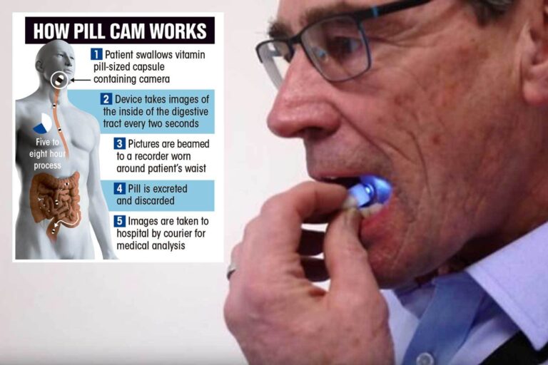 Tiny camera in a pill will allow patients to check for bowel cancer at home