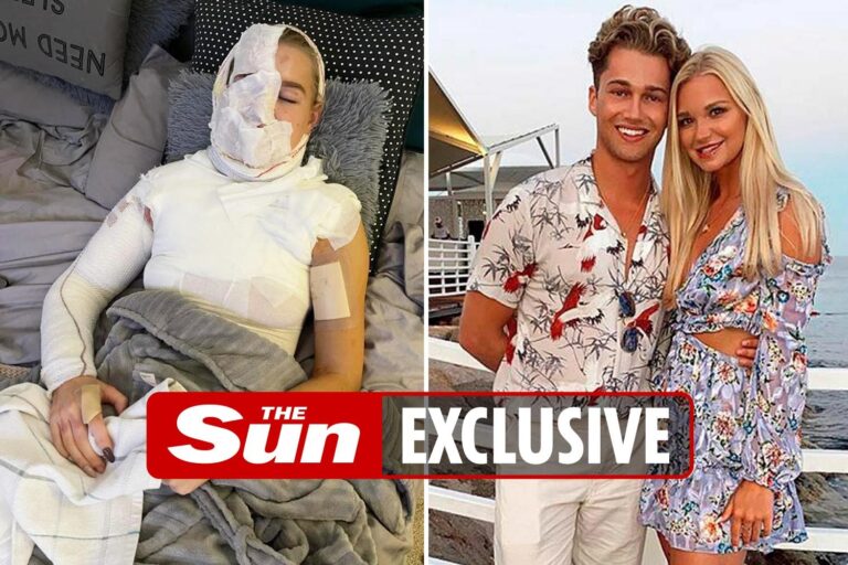 Strictly star AJ Pritchard’s girlfriend Abbie Quinnen engulfed in fire after social media video went…