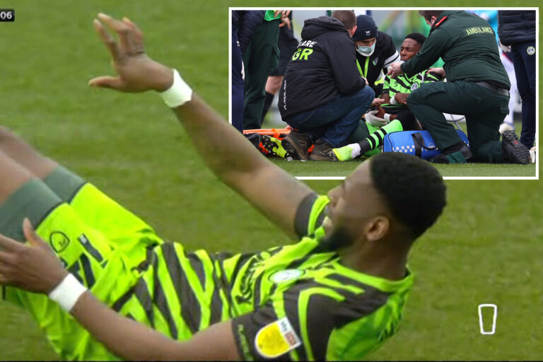 Forest Green Rovers’ Jamille Matt’s fingers bent out of shape in horror injury before distraught…
