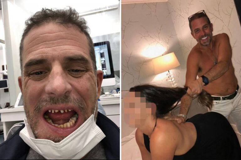 Shock pics show Hunter Biden with destroyed teeth before getting veneers & smiling while ‘posing in…