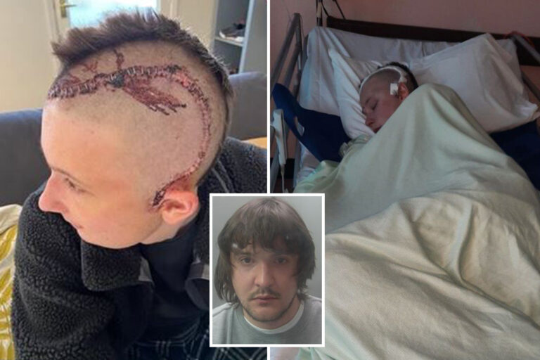 Shocking injuries of police officer left with serious brain injury after being punched on duty