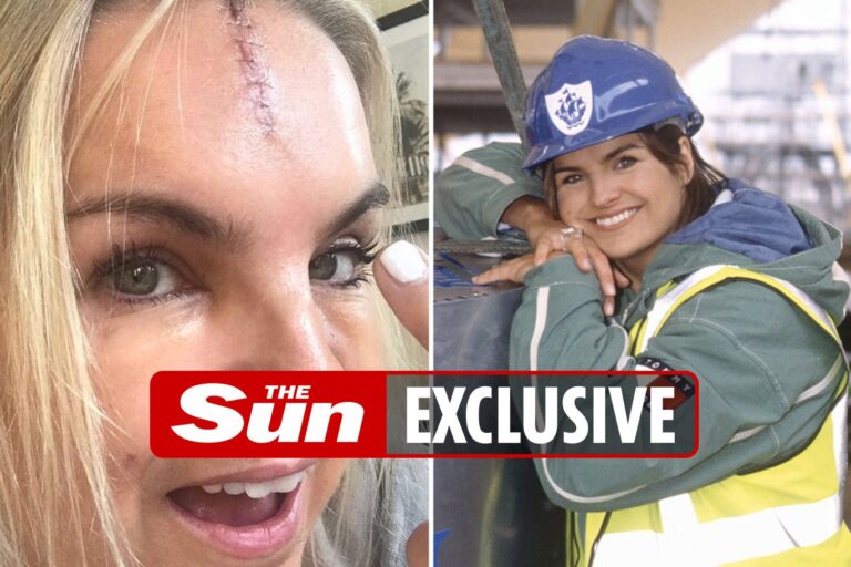 Former Blue Peter star Katy Hill left scarred for life after head-butting the loo