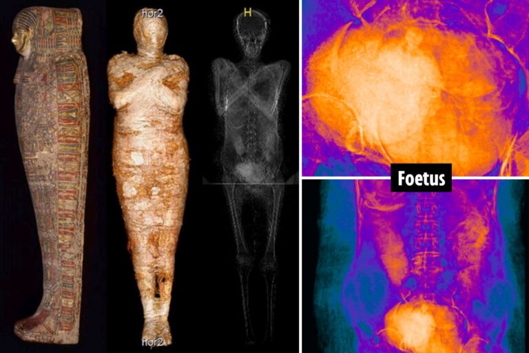 World’s first PREGNANT Ancient Egyptian mummy identified by scientists after X-ray scans of…