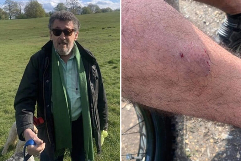Cyclist claims Holby City actor Robert Powell’s dog ‘bit him’ after posting pic of ‘mystery’ man