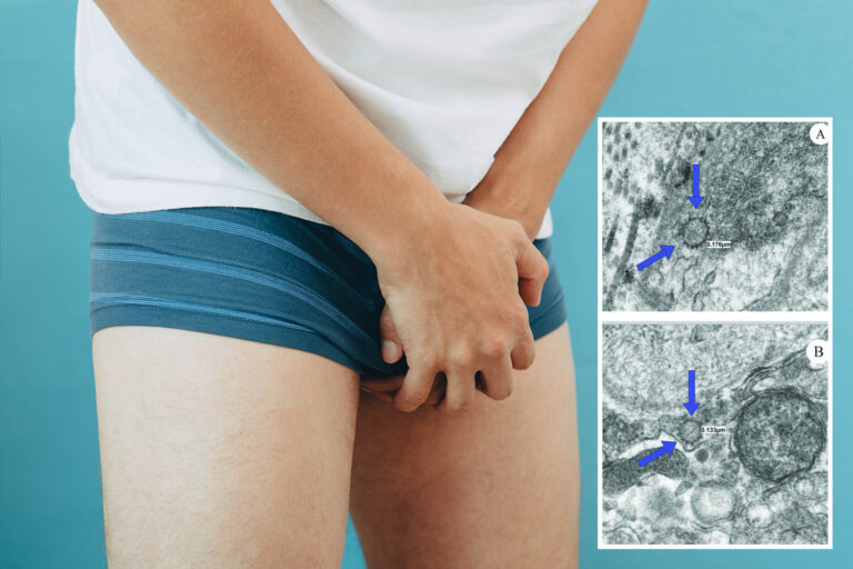 Coronavirus lingers in men’s penises for six months after infection – increasing risk of impotence