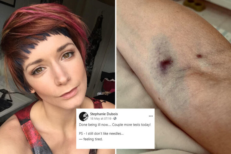 Model Stephanie Dubois reveals she felt ‘horrendous’ & showed bruised arm in last posts before dying…