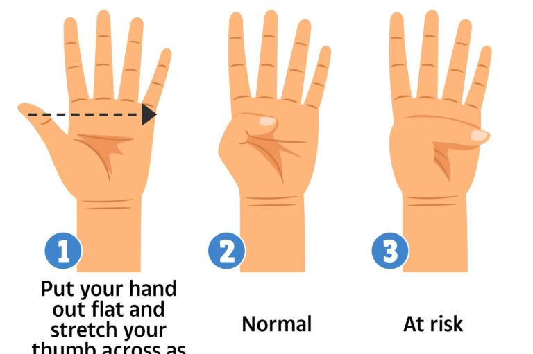 Simple thumb tests can reveal if you’re at risk of deadly heart problem