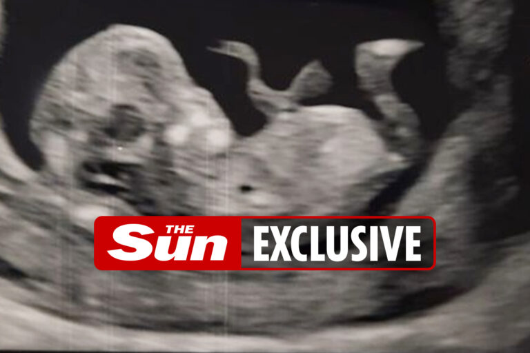 Baby set to be Tottenham Hotspur fan like his dad after club cockerel appears on ultrasound scan