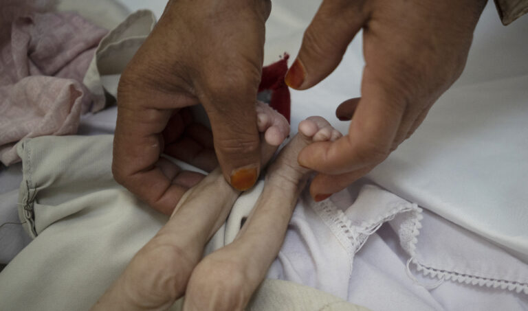 Sharp jump in number of people facing famine: UN