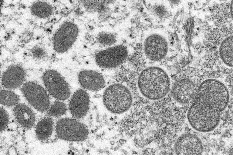 South Africa records first case of monkeypox