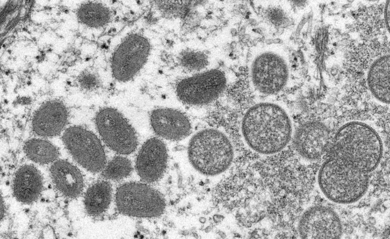 WHO turns to public for monkeypox name change